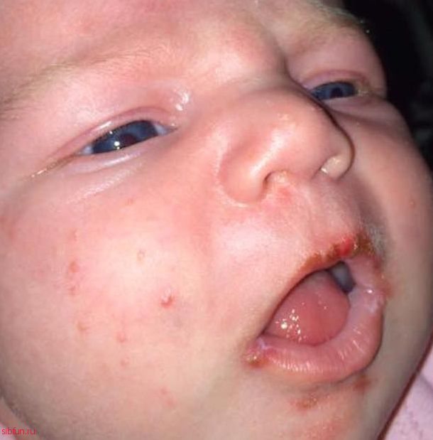 Мама шокировала Facebook, показав, почему нельзя целовать новорожденных
