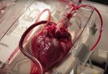 Изобретен аппарат, заставляющий сердце биться без тела