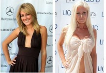 Неудачные пластические операции знаменитостей