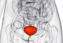 10 советов от врачей о том, как защититься от инфекций мочевыводящих путей