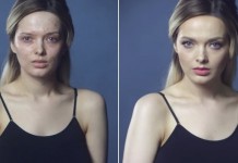 Вот домашние средства, чтобы избавиться от прыщей и шрамов от них навсегда!