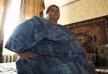 Самой тяжелой женщине России сделали операцию