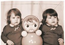 Как живут сейчас первые удачно разделенные в СССР сиамские близнецы