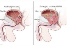 Странности и несовершенства в строении человеческого тела