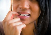 Как перестать грызть ногти