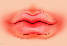 Что губы могут рассказать о вашем здоровье