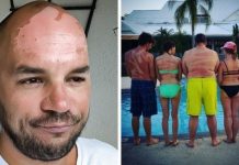 17 фотографий людей, которые перестарались с загаром # 31.07.2020