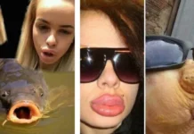 Губы, как батуты: мужские мысли о моде на накачку