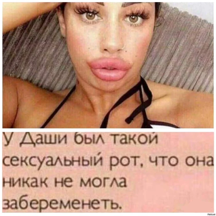 Губы, как батуты: мужские мысли о моде на накачку