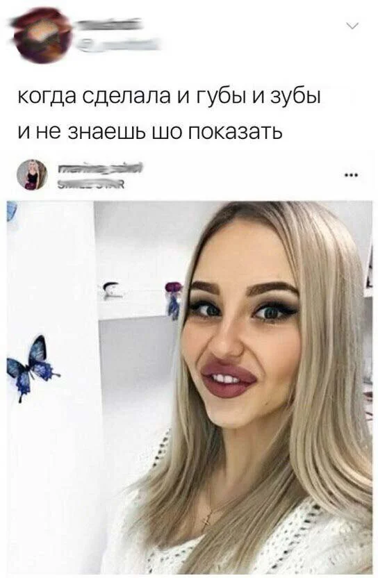 Губы, как батуты: мужские мысли о моде на накачку