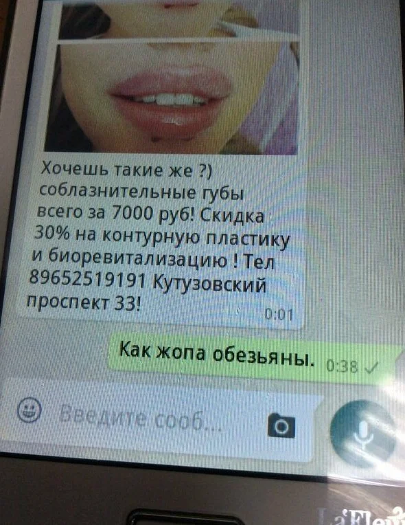Губы, как батуты: мужские мысли о моде на накачку