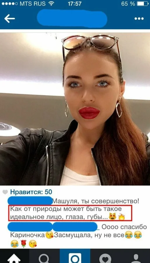 Губы, как батуты: мужские мысли о моде на накачку