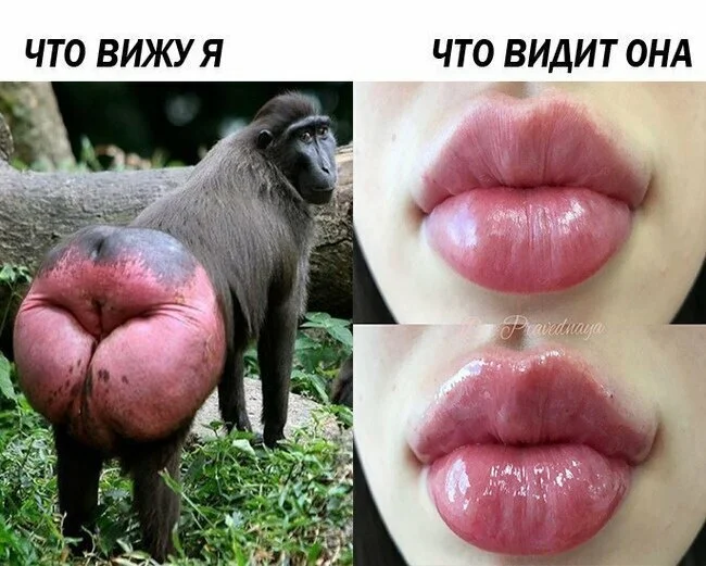 Губы, как батуты: мужские мысли о моде на накачку