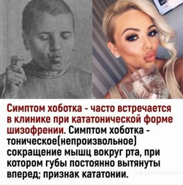 А, ну теперь понятно